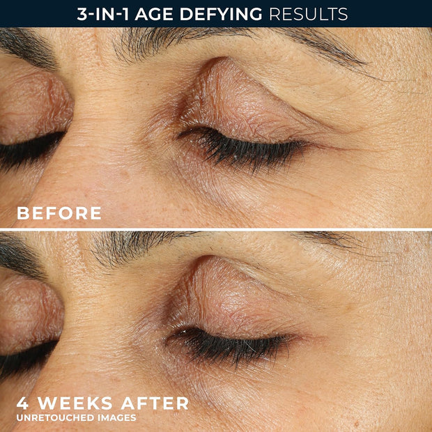 Roc Retinol Correxion Line Smoothing Eye Cream, Reduces Puffiness & Dark Circles, anti Wrinkle & anti Aging Treatment for the Delicate Eye Area - 15Ml