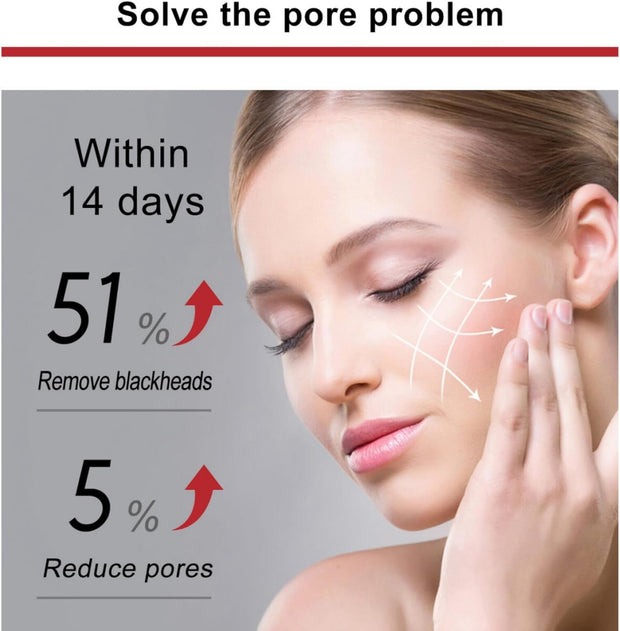 2Pcs Mandelic Acid 10% Ha,Gentle Skin Exfoliator for Face,Hyaluronic Acid Serum to Improve Dull Skin,Face Dry Skin Care Moisturizer,Face Serum to Moisturizing Control Excess Oil,Serum for Woman