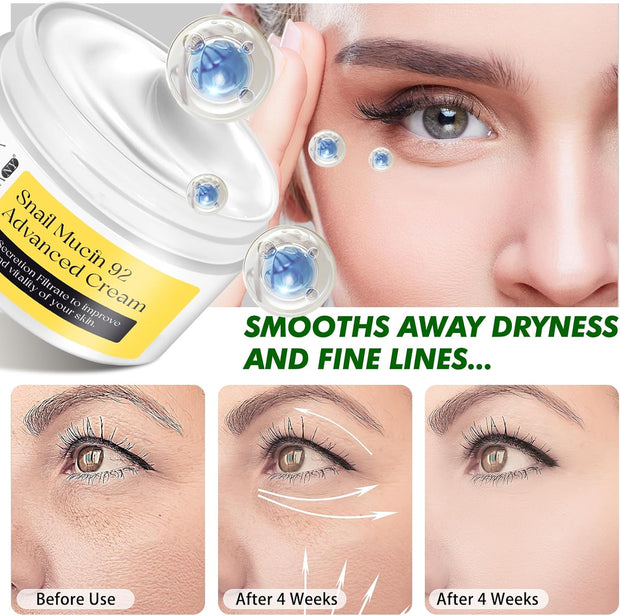 Snail Mucin Moisturizer - Snail Mucin Serum Cream, Face Moisturizer with Advanced Snail 92 Mucin Essence, Face Moisturizing Cream for Dry Skin, Day & Night Korean Skin Care Repair Cream