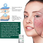 50Ml Centella Asiatica Hydrating Serum,Anti-Aging Face Serum,Skincare Serum,Hyaluronic Acid Serum,Face Serum for Women with Hyaluronic Acid,Anti Wrinkle Face Cream,Serums Skincare,Facial Moisturiser