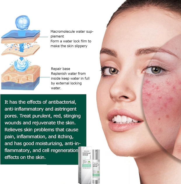 50Ml Centella Asiatica Hydrating Serum,Anti-Aging Face Serum,Skincare Serum,Hyaluronic Acid Serum,Face Serum for Women with Hyaluronic Acid,Anti Wrinkle Face Cream,Serums Skincare,Facial Moisturiser