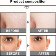 2Pcs Mandelic Acid 10% Ha,Gentle Skin Exfoliator for Face,Hyaluronic Acid Serum to Improve Dull Skin,Face Dry Skin Care Moisturizer,Face Serum to Moisturizing Control Excess Oil,Serum for Woman