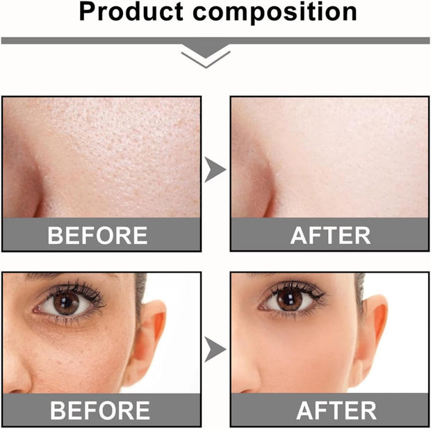 2Pcs Mandelic Acid 10% Ha,Gentle Skin Exfoliator for Face,Hyaluronic Acid Serum to Improve Dull Skin,Face Dry Skin Care Moisturizer,Face Serum to Moisturizing Control Excess Oil,Serum for Woman