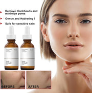 2Pcs Mandelic Acid 10% Ha,Gentle Skin Exfoliator for Face,Hyaluronic Acid Serum to Improve Dull Skin,Face Dry Skin Care Moisturizer,Face Serum to Moisturizing Control Excess Oil,Serum for Woman