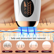 Laser Epilator IPL Hair Removal for Women Body Bikini Facial 990000 Flashes Permanant Painless IPL Hair Remover Laser Epilator