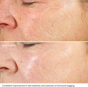 Retinol Face Cream with Hyaluronic Acid & Vitamin E – Anti-Wrinkle Firming Night Cream - Hydrating Night Moisturiser to Reduce Lines and Wrinkles. for Sensitive Skin, 50Ml