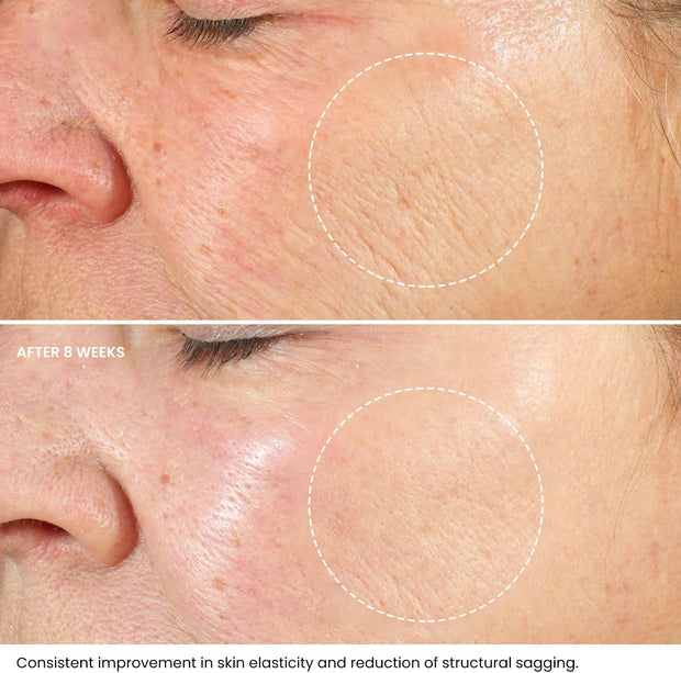 Retinol Face Cream with Hyaluronic Acid & Vitamin E – Anti-Wrinkle Firming Night Cream - Hydrating Night Moisturiser to Reduce Lines and Wrinkles. for Sensitive Skin, 50Ml