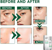 50Ml Centella Asiatica Hydrating Serum,Anti-Aging Face Serum,Skincare Serum,Hyaluronic Acid Serum,Face Serum for Women with Hyaluronic Acid,Anti Wrinkle Face Cream,Serums Skincare,Facial Moisturiser