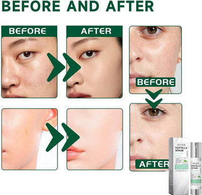 50Ml Centella Asiatica Hydrating Serum,Anti-Aging Face Serum,Skincare Serum,Hyaluronic Acid Serum,Face Serum for Women with Hyaluronic Acid,Anti Wrinkle Face Cream,Serums Skincare,Facial Moisturiser