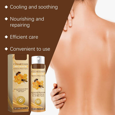 Bee Venom Spray - Bee Venom Skin Care - Bee Venom Essence Body Moisturizer - Whole Body,Back,Leg,Arm - anti Aging Wrinkle Bee Venom Care Spray for Acne - Tender,Smooth Skin 20Ml
