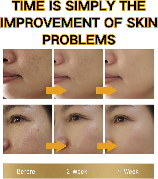 Brightening Repair Face Cream - Face Cream for Women - Face Moisturiser for Dark Spot Correcting - Moisturizing and Anti-Blemish Spot Cream