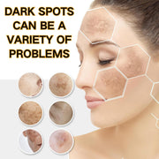Brightening Repair Face Cream - Face Cream for Women - Face Moisturiser for Dark Spot Correcting - Moisturizing and Anti-Blemish Spot Cream