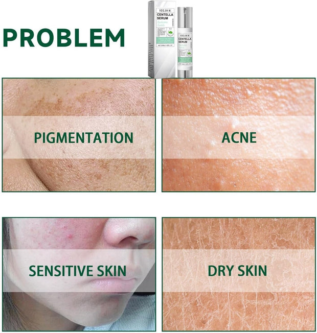 50Ml Centella Asiatica Hydrating Serum,Anti-Aging Face Serum,Skincare Serum,Hyaluronic Acid Serum,Face Serum for Women with Hyaluronic Acid,Anti Wrinkle Face Cream,Serums Skincare,Facial Moisturiser